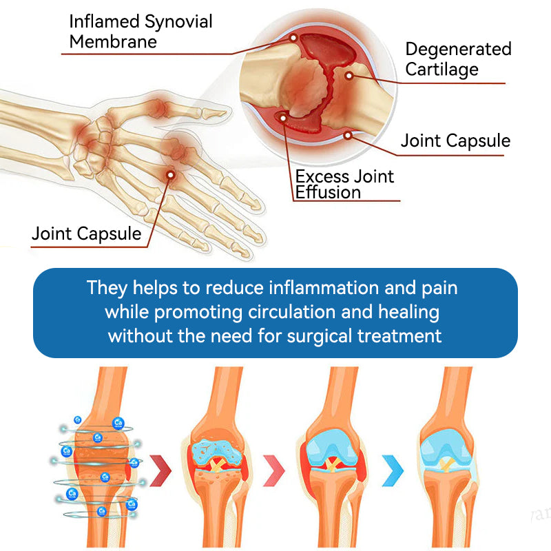 𝐋𝐢𝐩𝐌𝐚𝐩𝐬® BPC-157 Joint & Gout Relief Cream🦴Treats Arthritis, Neuropathy, Rheumatism, Sports Injuries & More🚁