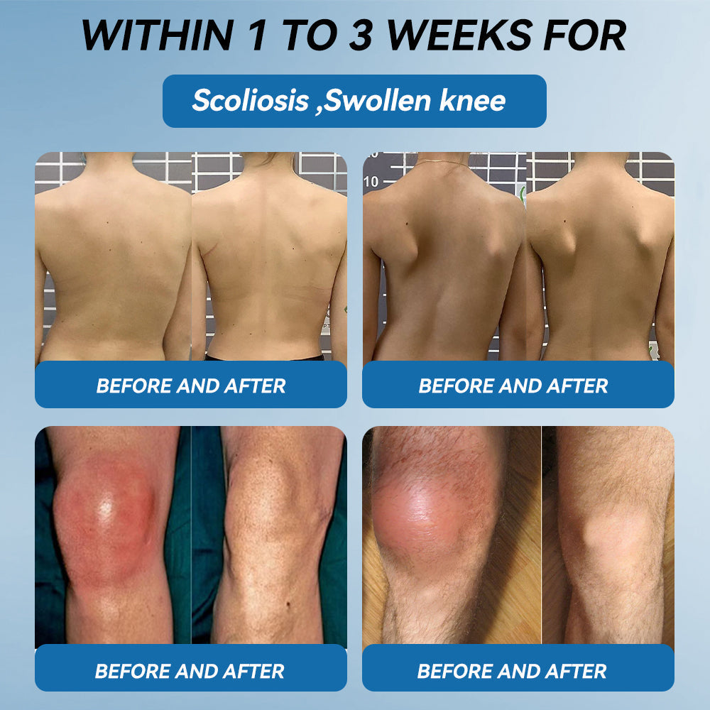 𝐋𝐢𝐩𝐌𝐚𝐩𝐬® BPC-157 Joint & Gout Relief Cream🦴Treats Arthritis, Neuropathy, Rheumatism, Sports Injuries & More🚁