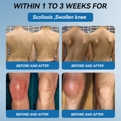 𝐋𝐢𝐩𝐌𝐚𝐩𝐬® BPC-157 Joint & Gout Relief Cream🦴Treats Arthritis, Neuropathy, Rheumatism, Sports Injuries & More🚁