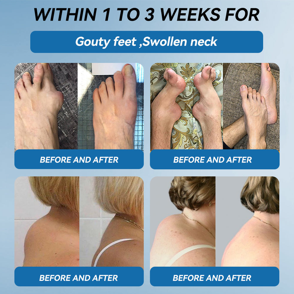 𝐋𝐢𝐩𝐌𝐚𝐩𝐬® BPC-157 Joint & Gout Relief Cream🦴Treats Arthritis, Neuropathy, Rheumatism, Sports Injuries & More🚁