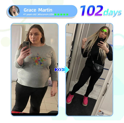 【WarmFamily® Official Store】 Tirzepatide Nano Microneedle Patch 🇺🇸👨‍⚕️（Zero Pain, 24/7 Release | Lose 20lbs FAST | 90% Sugar Drop | ）